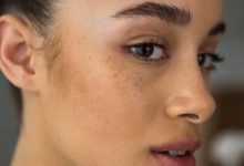 درمان گیاهی کک و مک